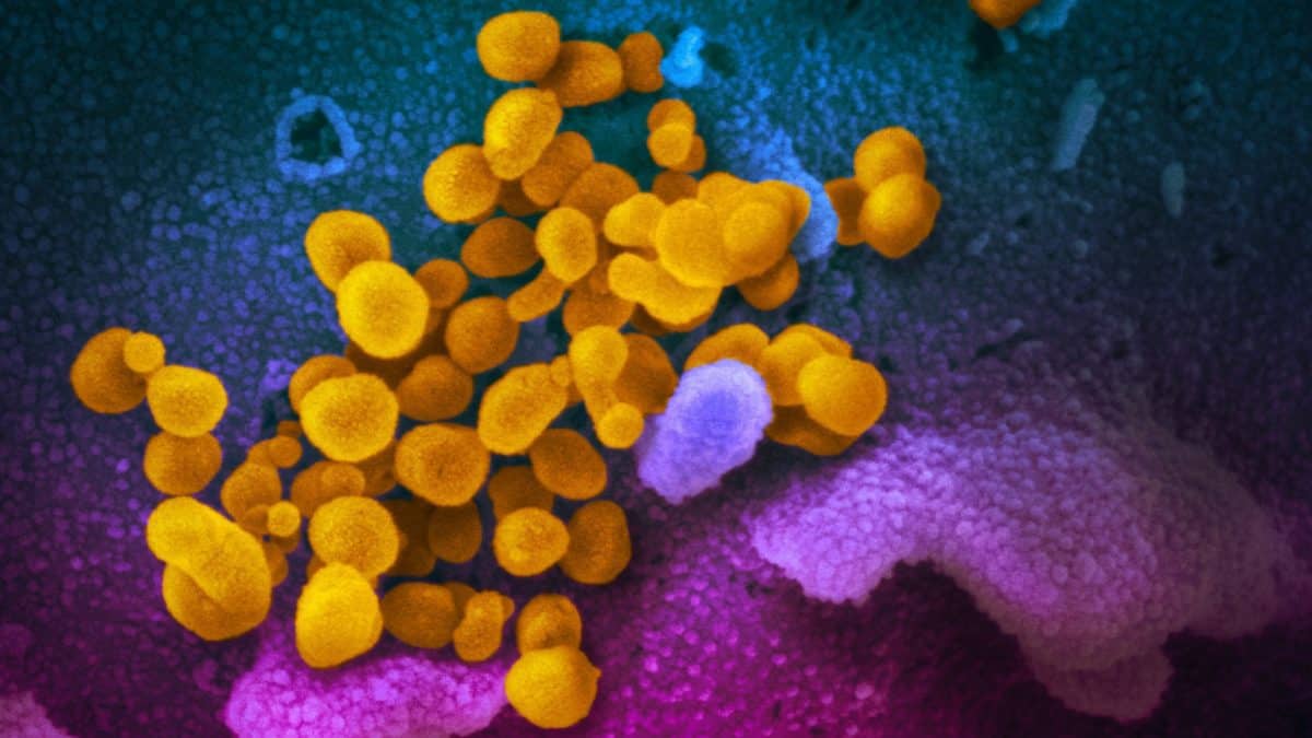 COVID-19 коронавирус: симптомы, инкубационный период, меры предосторожности. Опасность для пожилых людей.